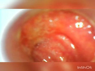 Usb endoscope 80 cm globoko analno vstavljanje, umazano video d2