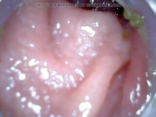 肛門 endoscope 部分 1, 免費 灌腸劑 懲罰 高清晰度 性別 視頻 04